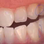 Gold Coast Dental - Brea