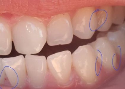 Gold Coast Dental - Brea