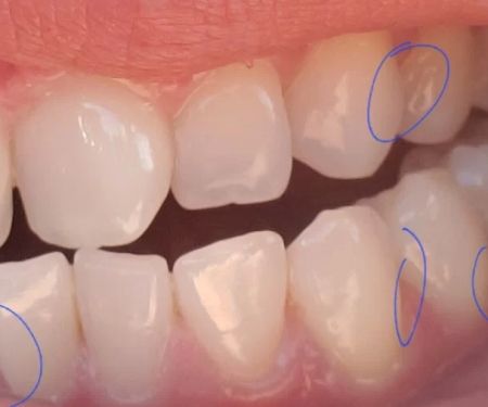 Gold Coast Dental - Brea
