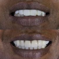 Dentist of Burbank, CA ico