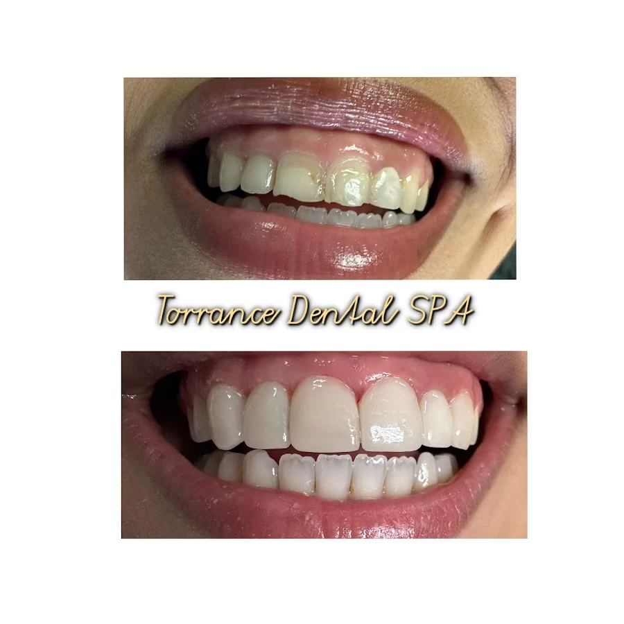 Torrance Dental Spa 6