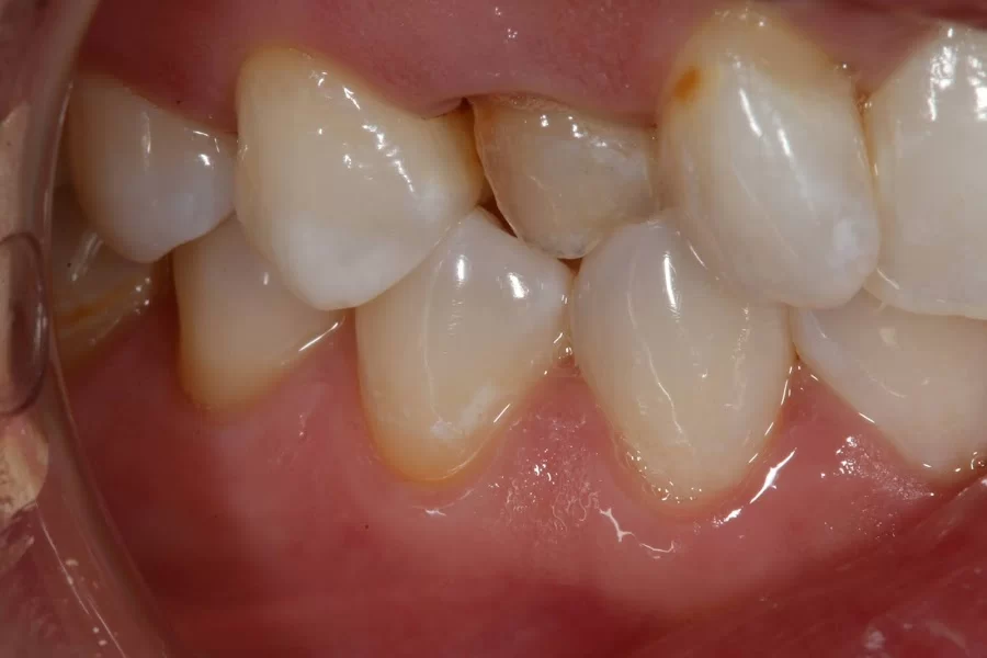 implantasmile.com | Antoine S. Sayegh, DDS 6