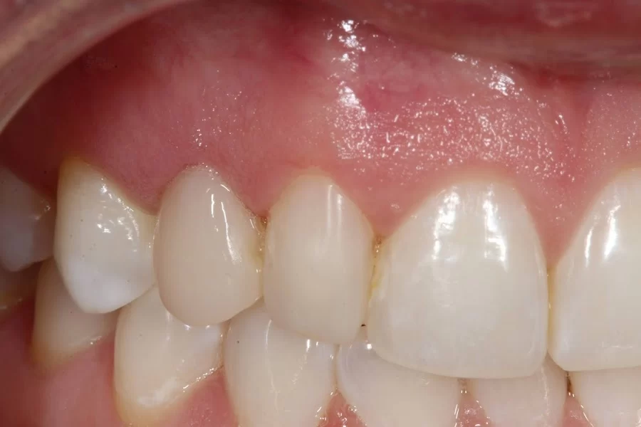 implantasmile.com | Antoine S. Sayegh, DDS 5