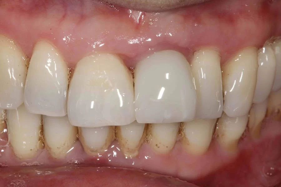 implantasmile.com | Antoine S. Sayegh, DDS 1