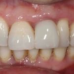 implantasmile.com | Antoine S. Sayegh, DDS