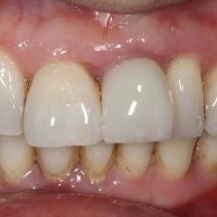 implantasmile.com | Antoine S. Sayegh, DDS ico