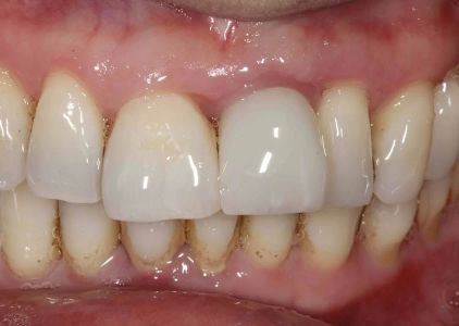 implantasmile.com | Antoine S. Sayegh, DDS