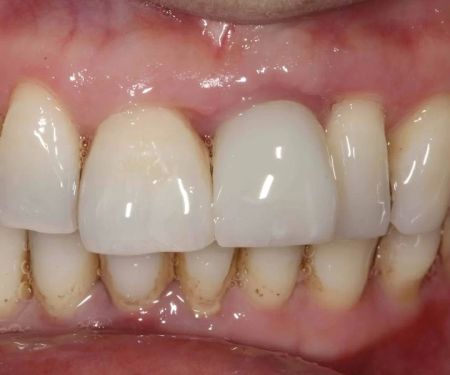 implantasmile.com | Antoine S. Sayegh, DDS