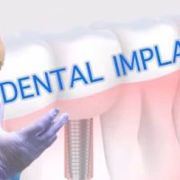 Cypress Dental ico