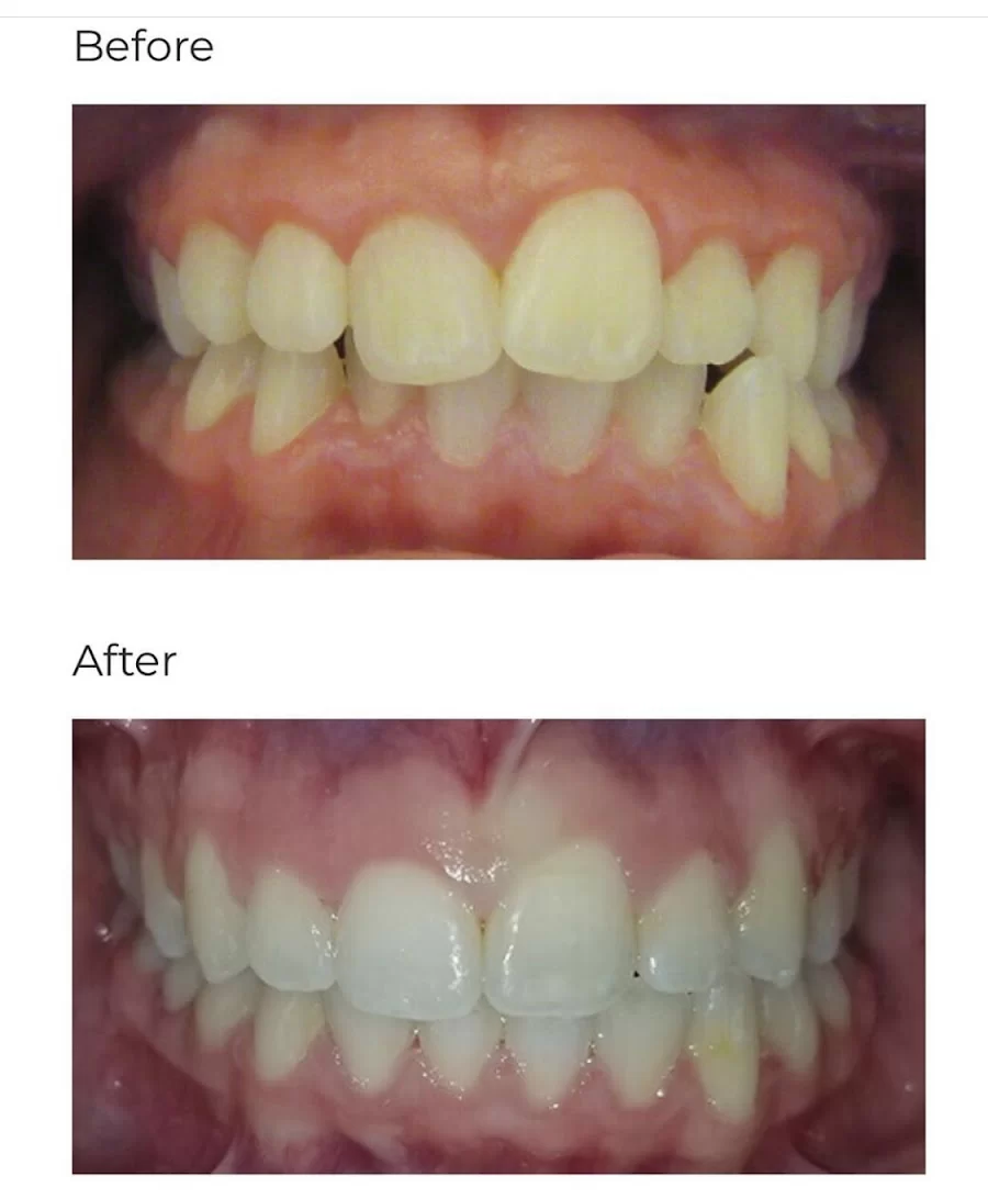 Calismile Orthodontics 7