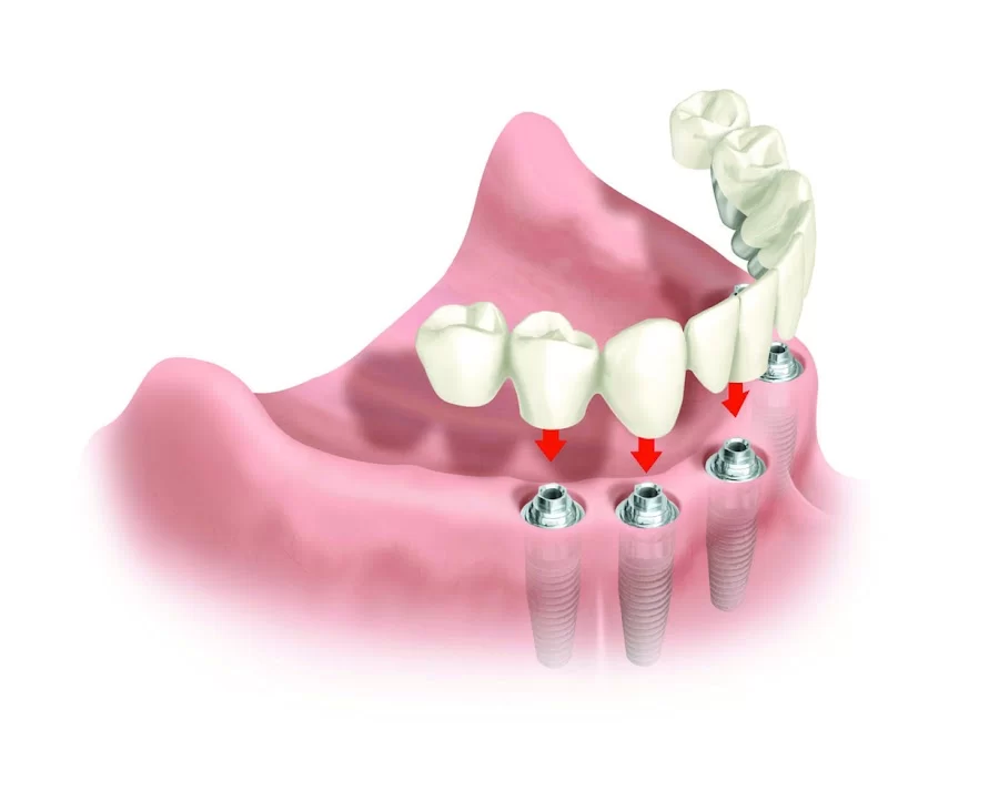 Pacific Dental & Implant Solutions 1