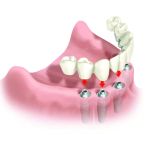 Pacific Dental & Implant Solutions