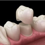 Madison Family Dental Associates