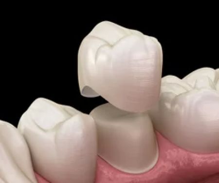 Madison Family Dental Associates