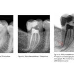 Bauman Endodontics Richard Bauman DMD
