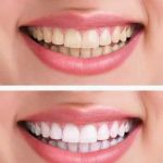 Oral Health Clinic