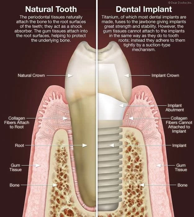 Redwood Dental Care 7