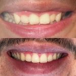 Holt Dental Care