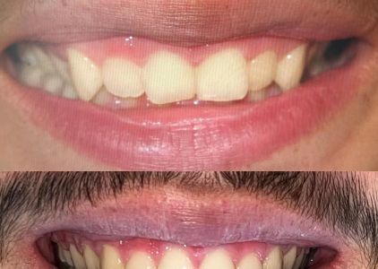 Holt Dental Care