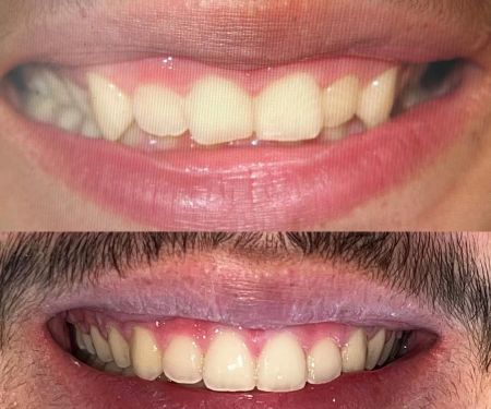Holt Dental Care
