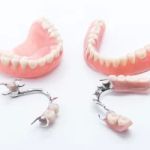 All Smiles Family Dentistry - Dentures, Extractions, Dental Implants, Quick Dentures