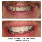 Pinecrest Dental: Dr. Tyler Williams - Biomimetic Dentistry & Implants