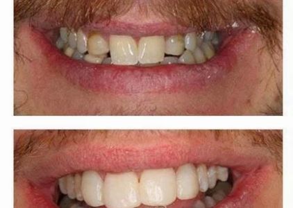 Pinecrest Dental: Dr. Tyler Williams - Biomimetic Dentistry & Implants
