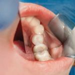 Family Dental of Fort Myers