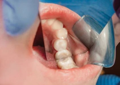 Family Dental of Fort Myers