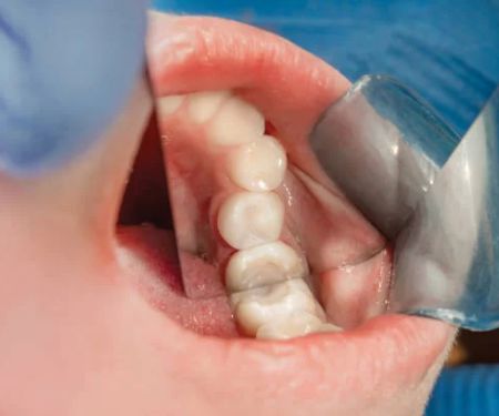 Family Dental of Fort Myers