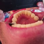 Young Family Dental West Jordan