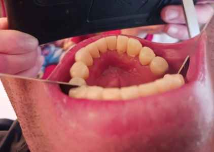 Young Family Dental West Jordan