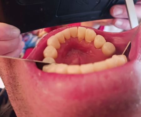 Young Family Dental West Jordan