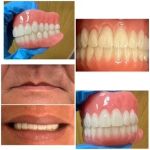 Desert Palms Dental