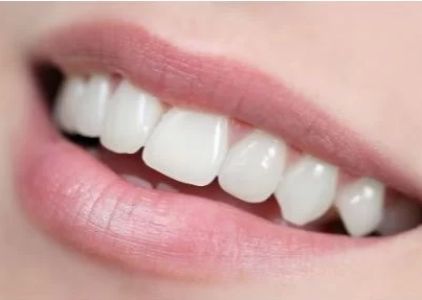 Jeffersonville Commons Dental