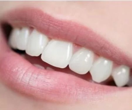Jeffersonville Commons Dental