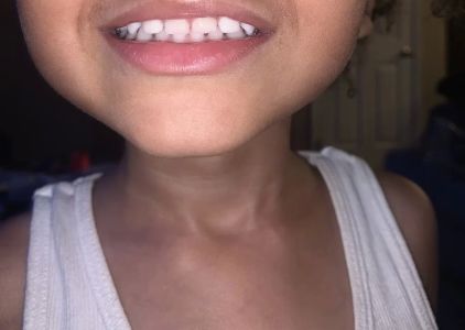 Children's Dentistry