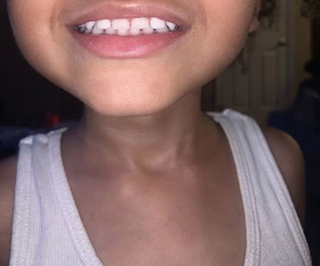 Children's Dentistry