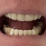 Drs. Barker, Rohner & Hunt DMD, PLLC