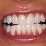 Southwest Vegas Smiles