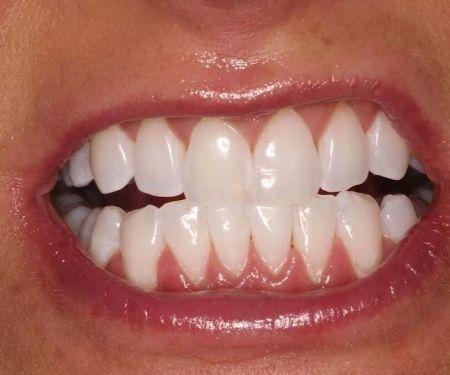 Southwest Vegas Smiles