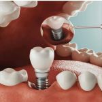 Vegas Dental Experts