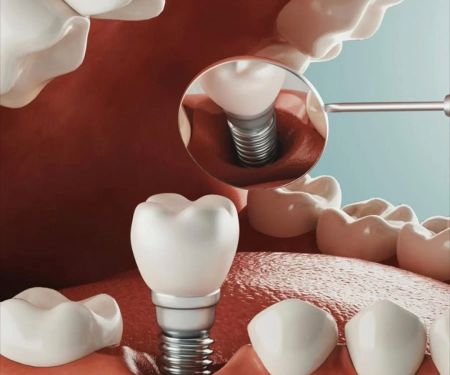 Vegas Dental Experts