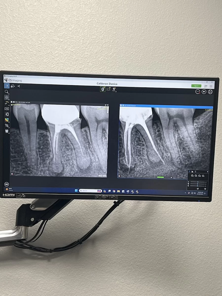 Apex Endodontics of Las Vegas 6