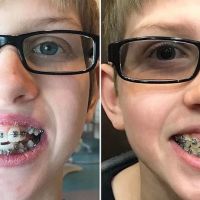 Las Vegas Braces ico