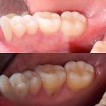Ed De Andrade : Anthem Periodontics and Dental Implants