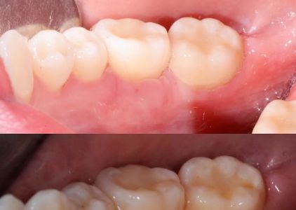 Ed De Andrade : Anthem Periodontics and Dental Implants