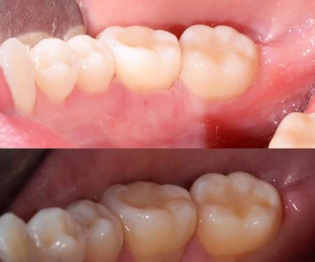 Ed De Andrade : Anthem Periodontics and Dental Implants