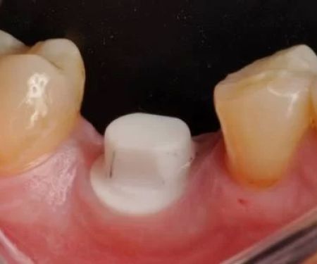 John G Masso DDS- Belcourt Family Dentistry PC