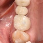 Healthy Smiles Dental - Las Vegas Dentist